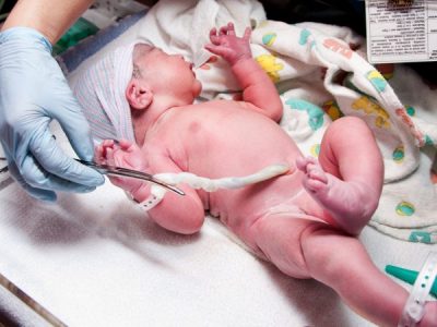 Why we must not cut the umbilical cord prematurely